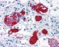 CRHR2 / CRF2 Receptor Antibody (N-Terminus)
